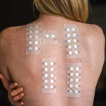 The Science Behind Allergy Testing