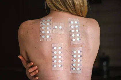 The Science Behind Allergy Testing