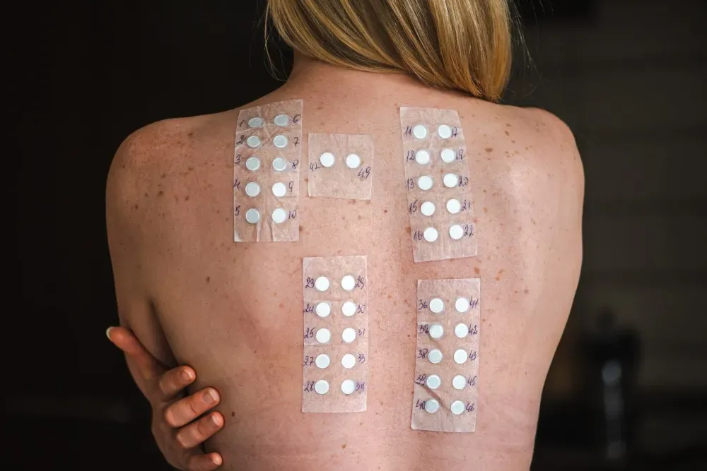 The Science Behind Allergy Testing