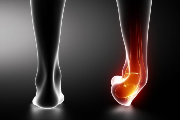 How a Podiatrist Can Help With Foot and Ankle Sports Injuries